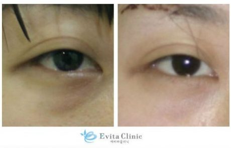 71d90847ce48032c33b9bde9e7ff9abe