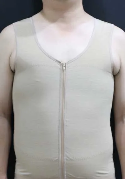 Gynecomastia_Garment_01