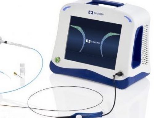 ClosureFast™ (RF) Ablation : Expert Varicose Vein Treatment