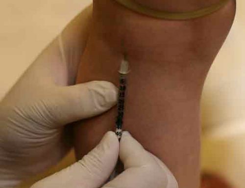 What is Sclerotherapy?