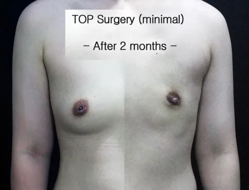 TOP Surgery, minimal incision