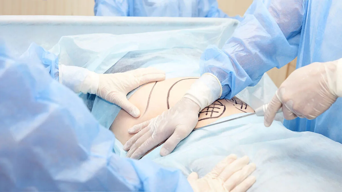 tummy_operation