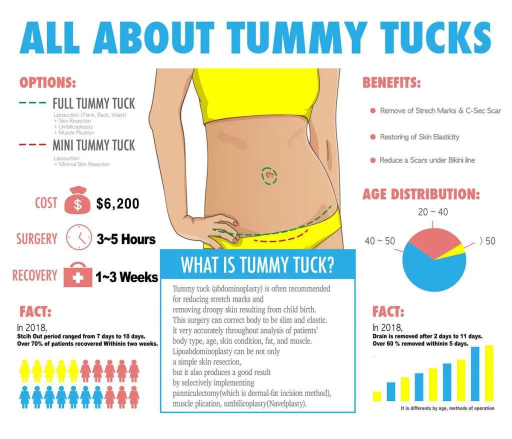 All_About_Tummy_tuck