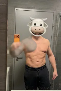 Tummy_Liposuction_202604 Male abdominal liposuction 1 month result mirror selfie showing flat abdomen and muscle definition