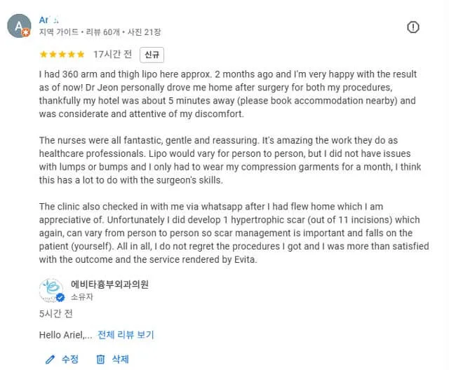 Google review from an international patient describing a positive experience with 360 arm and thigh liposuction at Evita Clinic in Seoul