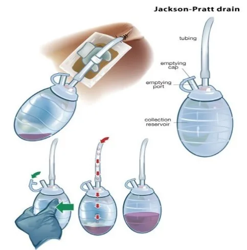 JP drain management guide