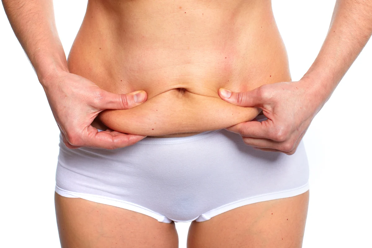 Loose abdominal skin assessed for tummy tuck within body lift surgery