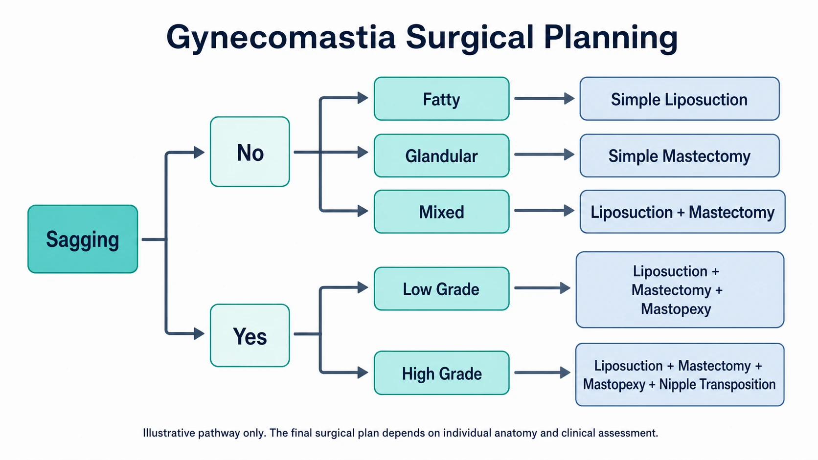 Gynecomastia surgical planning flowchart showing how skin sagging and tissue composition may influence treatment options